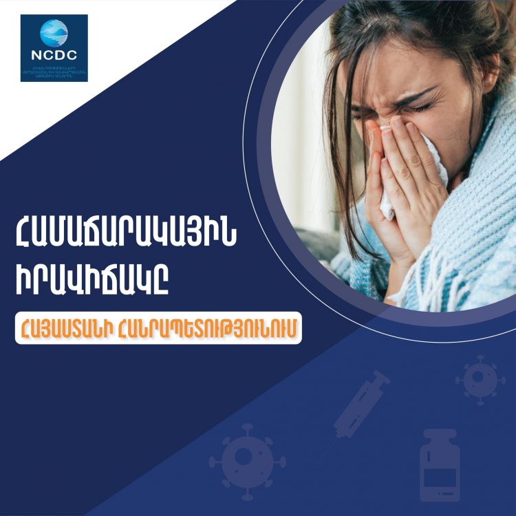 Թոքաբորբով հոսպիտալացվել է 578 պացիենտ․ մետապնևմավիրուս չի հայտնաբերվել․ ՀՎԿԱԿ